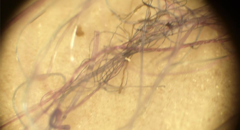 Illustration for article titled Inside Morgellons, the Internet's Disease